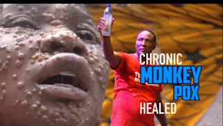 Woman Miraculously Healed Of Monkey Pox at Prophet Fufeyin’s Church 20