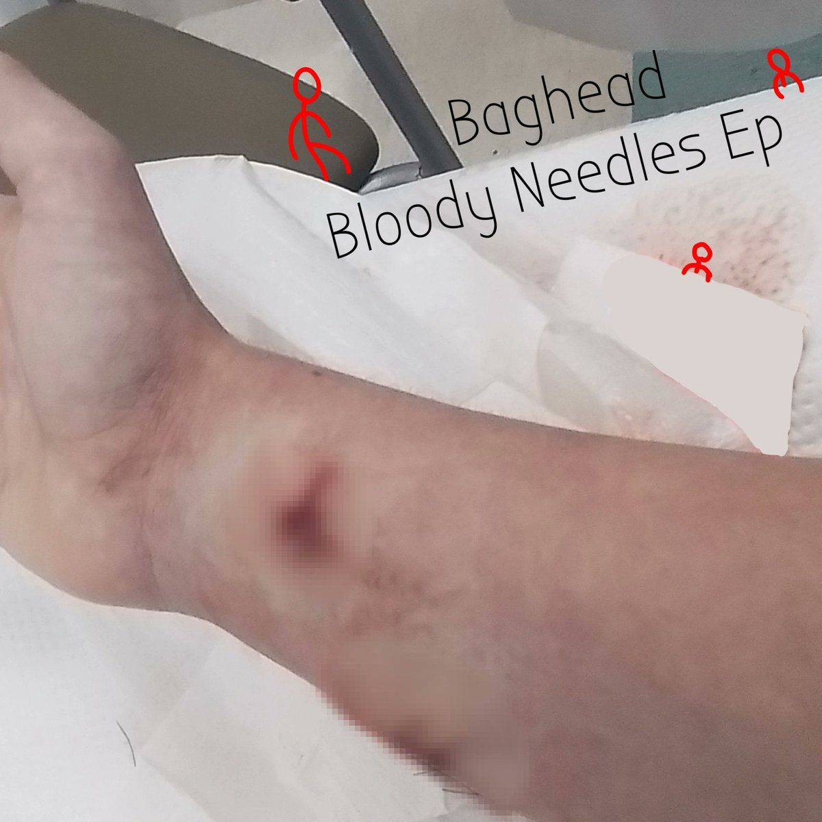 Baghead. Bloody Needles Zip Download