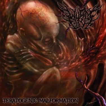 Wurm Flesh Teratogenic MalformationZip Download